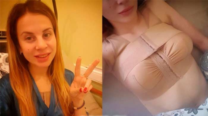 Ольга Ветер подтяжка груди